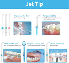 YOUNGDO Dental Jet Cleaning Nozzle, Replacement Jet Tips for Water Flosser Counter Irrigators
